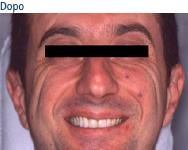 riabilitazionecaso2adopo