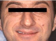riabilitazionecaso2aprima